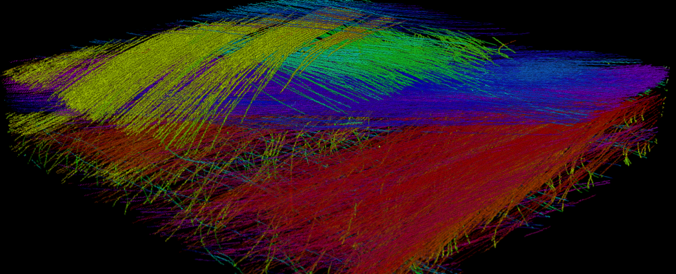 Orientation analysis in µCT of AL(OH)3 filled SMC