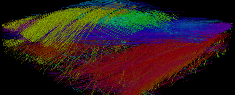 Orientation analysis in ÂµCT  of AL(OH)3 filled SMC